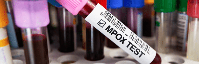 Mpox and Marburg virus outbreaks,,