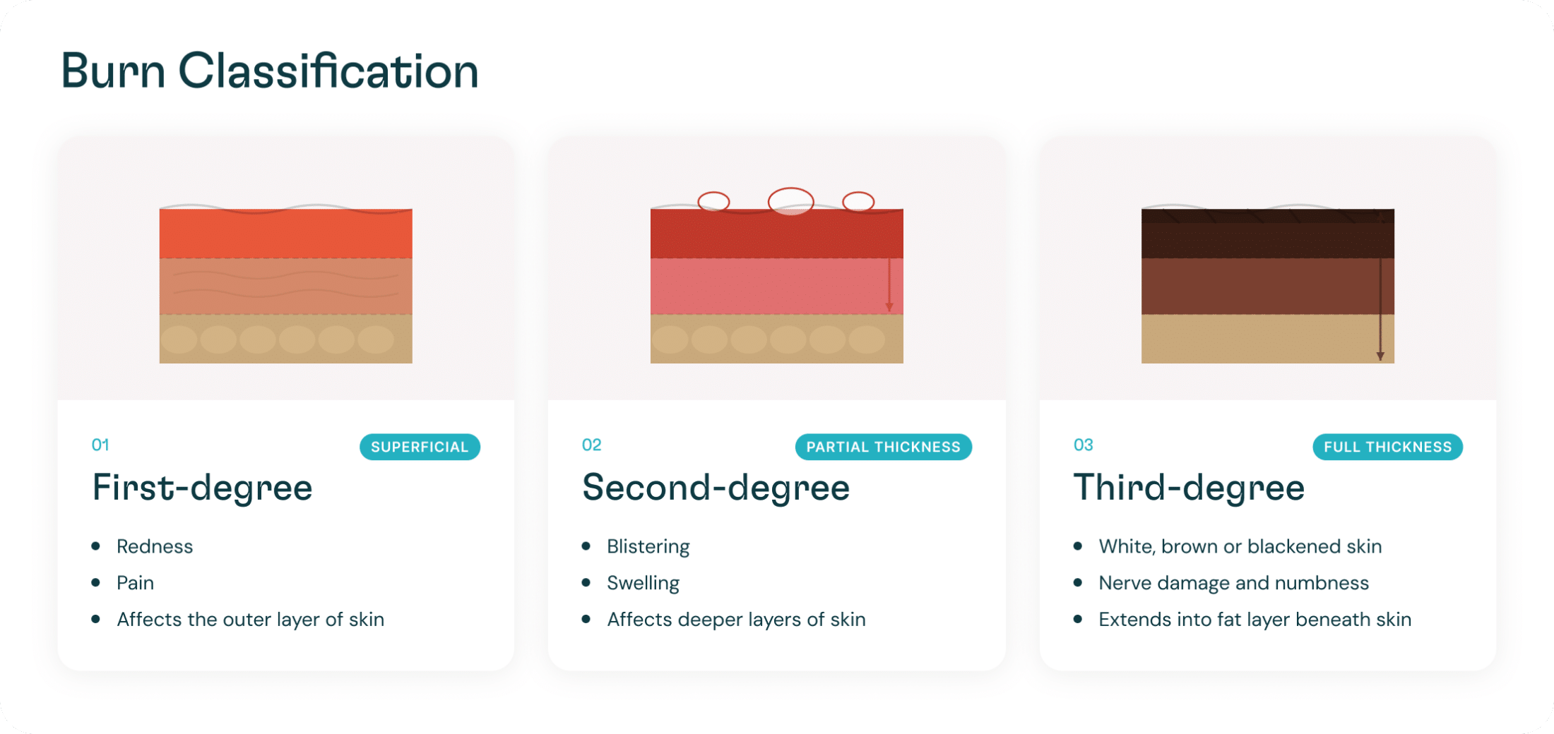 Burn Classification